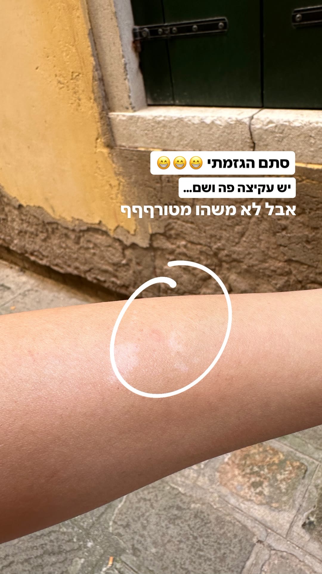 עקיצות יתושים בוונציה — לא נורא